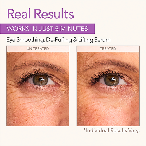 Skin Doctors Instant EyeLift Serum 10mL before and after view