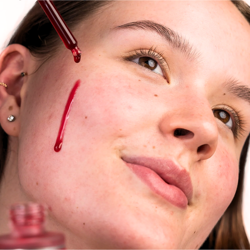 Skin Ritual 15% AHA+1% BHA Beginner Face Peeling Solution 30mL model using the product