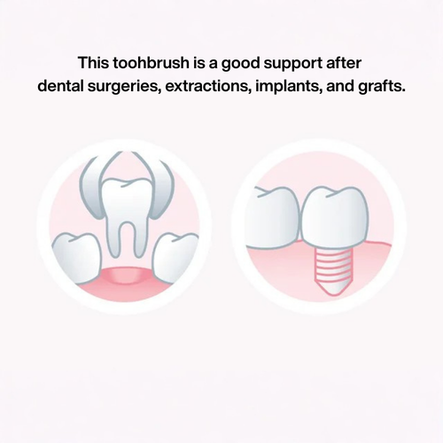 Infographic of GUM 317 Delicate Toothbrush Super Soft for Post-Surgery Care (Colour Selected at Random)