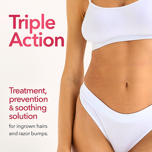 Skin Doctors Ingrow Go Lotion 120mL lifestyle image