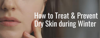 Winter Skin SOS: How to Treat & Prevent Dry Skin during Winter