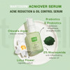 Martiderm Acniover Serum 30ml thumbnail
