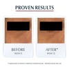 Eucerin Anti Pigment Eye Contour Cream 15ml thumbnail