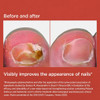 Isdin Si-Nails MicoXpert MD 4.5ml thumbnail
