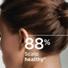 Bioderma Nodé K Shampoo 150 ml thumbnail