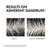 Vichy Dercos Technique Anti-Dandruff Shampoo 200 ml thumbnail