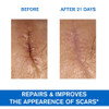 Uriage Bariéderm-CICA Multi-Purpose Restoring Cream 40 ml thumbnail
