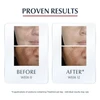 Eucerin Anti Pigment Spot Corrector 5 ml thumbnail