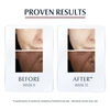 Eucerin Anti Pigment Face Day Cream SPF 30 50ml thumbnail