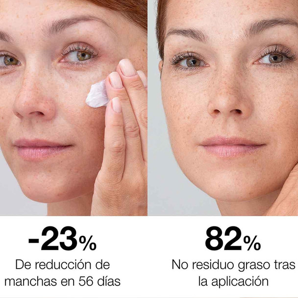 Bella Aurora Double Strength Original Combination to Oily Skin 30ml