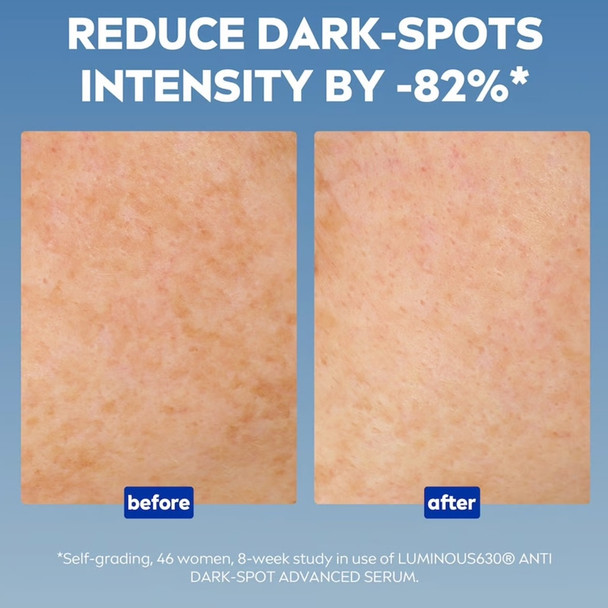 Nivea Luminous630 Advanced Cellular Anti-Dark Spot Treatment Serum 30 ml