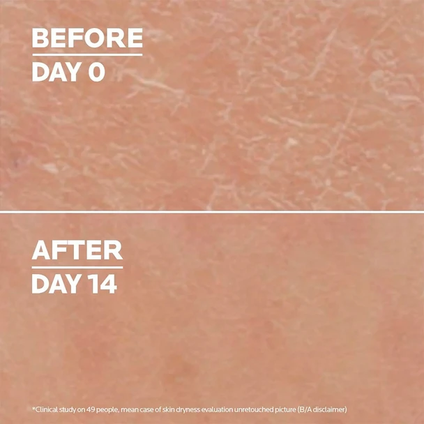 La Roche Posay Lipikar Lait Urea 10% 400 ml