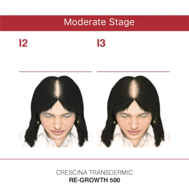 Crescina Transdermic HFSC Re-Growth 1300 Women 20 Ampoules 3.5 ml