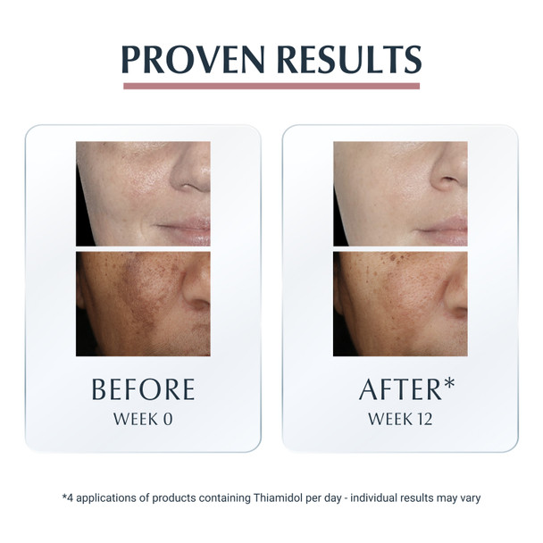 Eucerin Anti Pigment Spot Corrector 5 ml