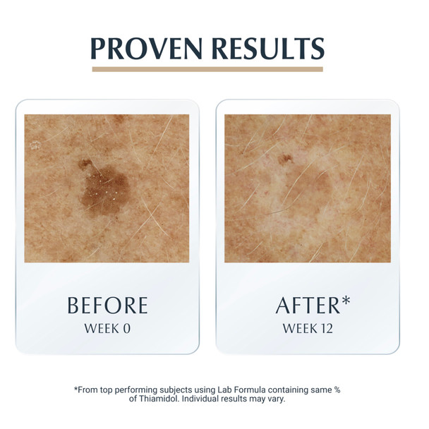Eucerin Hyaluron Filler+ Elasticity 3D Sérum 30ml