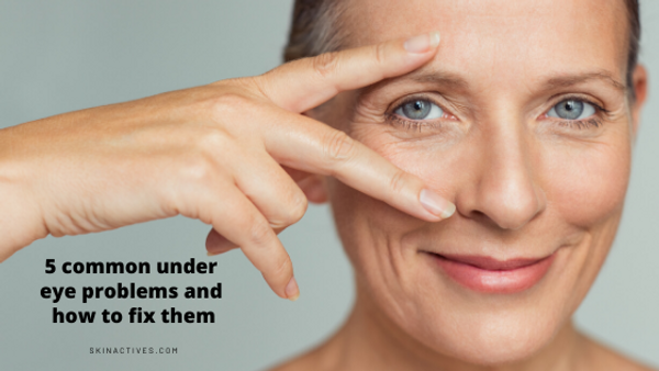 Puffy Eyes: 5 Quick Steps For Getting Rid Of The Problem