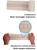 First Aid - Snake Bite Bandage