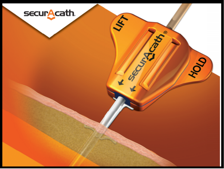400160 SecurAcath® 8 Fr Subcutaneous Anchor Securement Systems, Box of 10