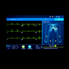 GE Mac 5 Lite Resting ECG