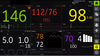 GE B105M, B125M, B155m Patient Monitor Screen