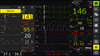 GE B105M, B125M, B155m Patient Monitor Bed to Bed screen