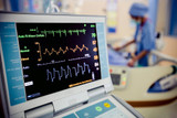 What Is an EKG Machine & How Does It Work?