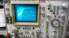 Hewlett Packard 1741A Oscilloscope 100MHz -AS-IS / FOR PARTS Bad Display