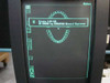 Sirona Cerec II CRT monitor screen displaying Crown 1.31 CS software copyright 2000 by Sirona Dental Systems