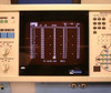 Nihon Kohden 4317B 16 Channel Electroencephalograph (EEG)