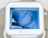 Lumenis Legend Pro touchscreen showing treatment mode selection screen with patient-controlled manual switch prompt