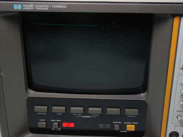 HP 78534C Monitor Terminal — close-up of CRT display and front panel controls including OVERVIEW, STORE, REAL TIME, DELAYED, CONTROL, CLEAR, LOCAL COPY, SUSPEND, SILENCE/RESET, and ALARMS buttons