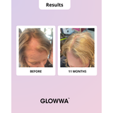 Glowwa Hair Food Trio Menopause 180 capsules