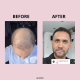 Glowwa Hair Food Original 60 capsules