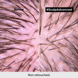 L'Oreal Pro Scalp Advanced Anti Dandruff Shampoo 1500ml