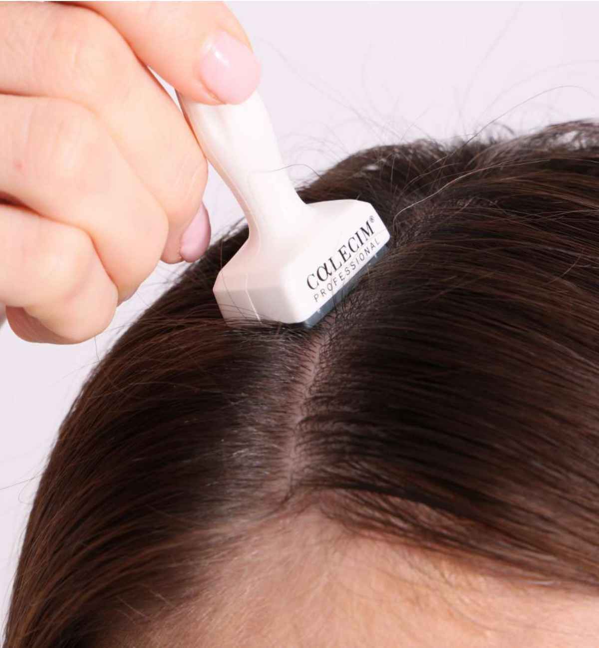 Thinning Scalp