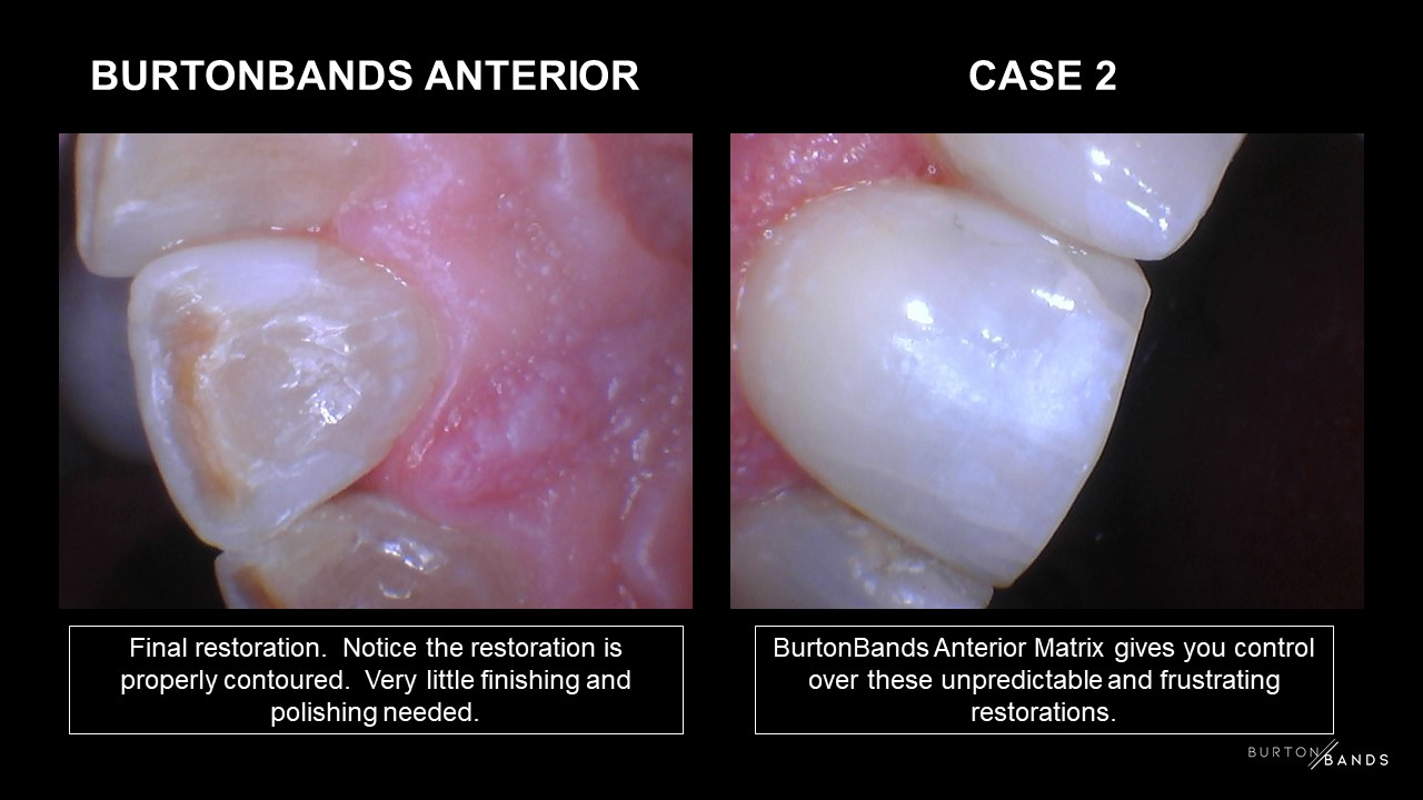 anterior-2.5.jpg