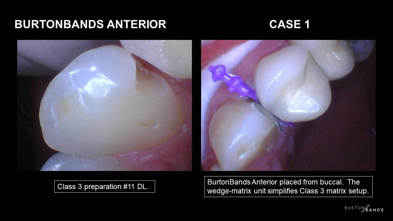 bb-anterior-1.2.jpg