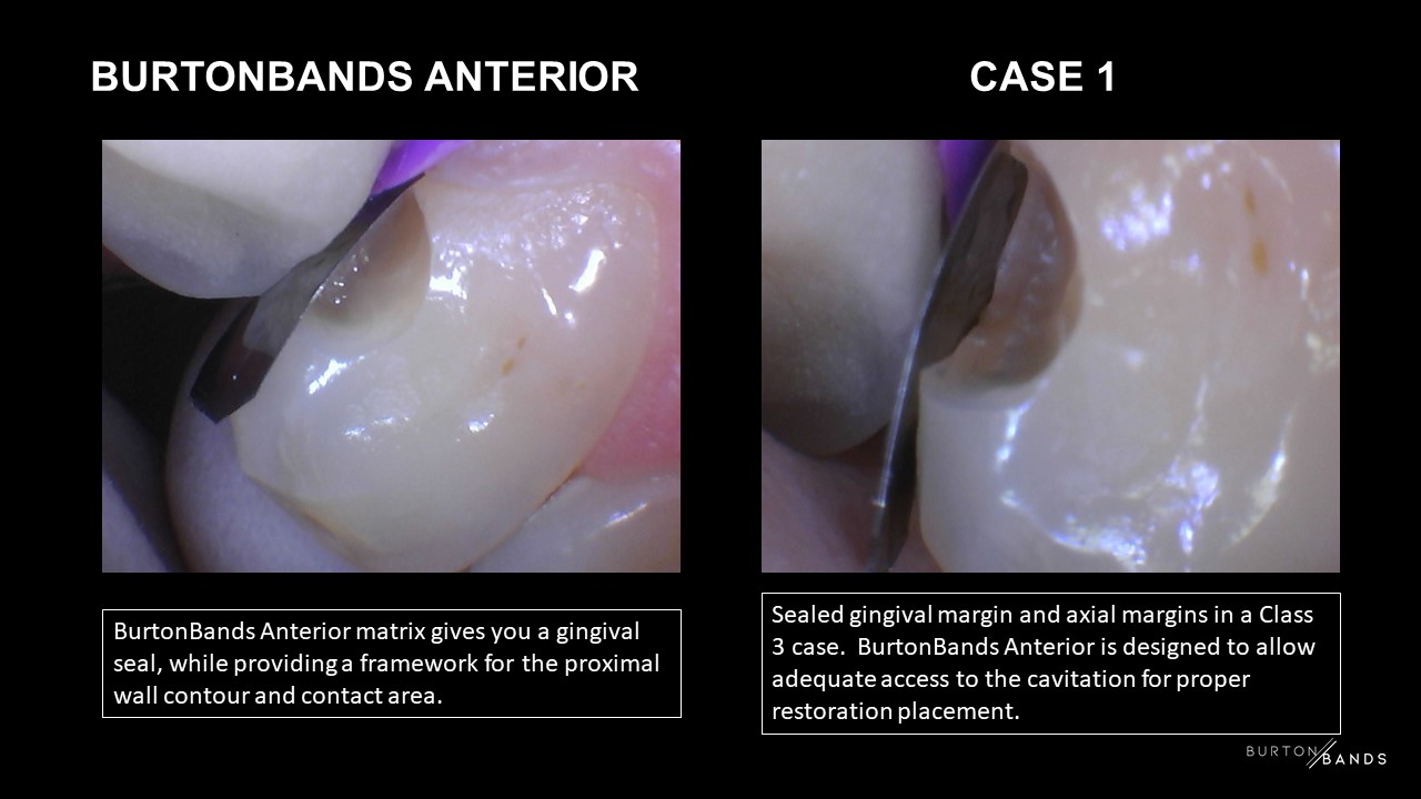 bb-anterior-1.3.jpg