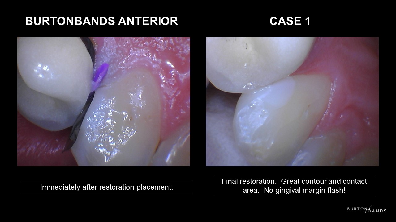 bb-anterior-1.5.jpg