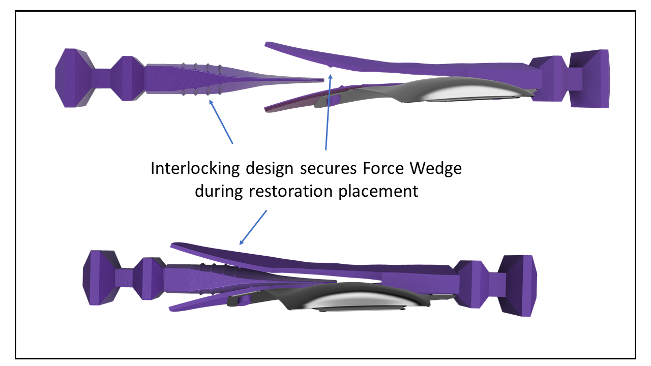 what-s-new-interlocking.png