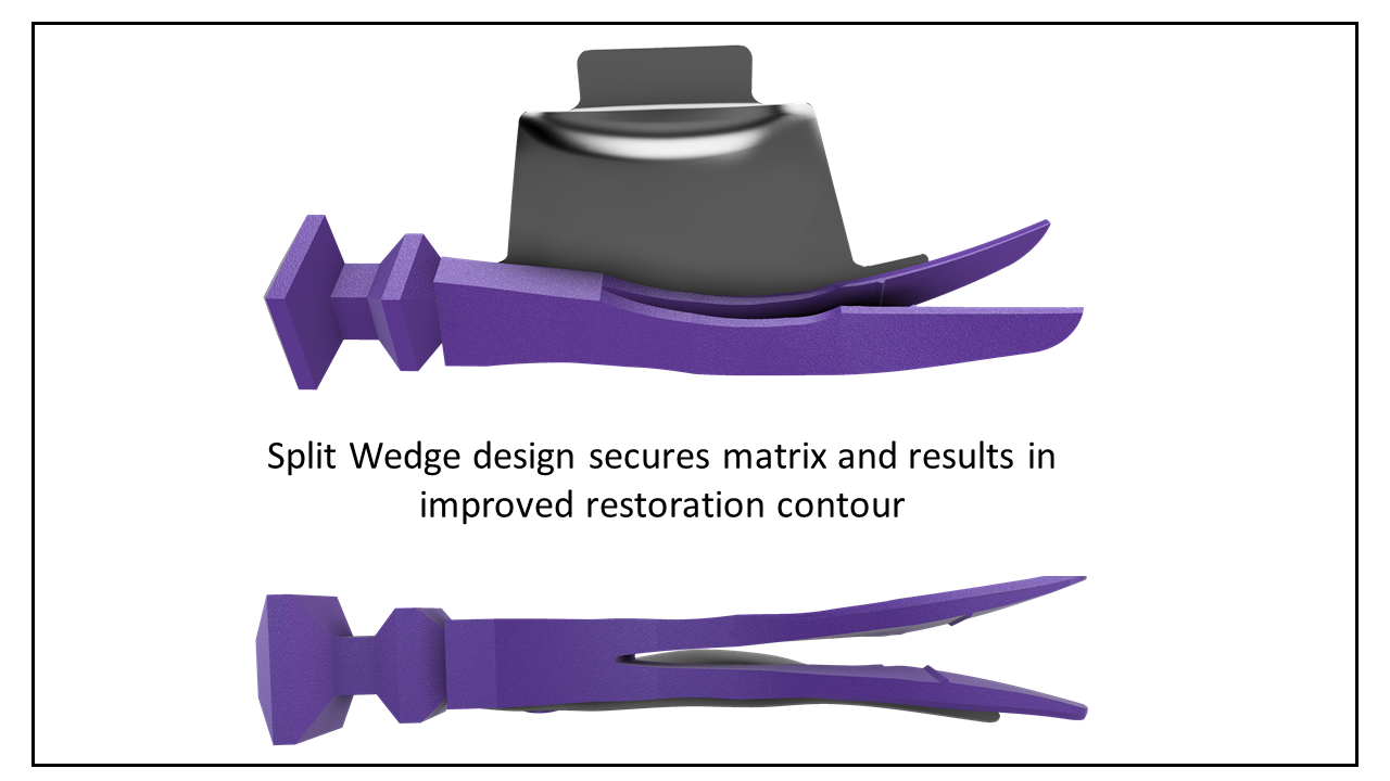 what-s-new-split-wedge.png