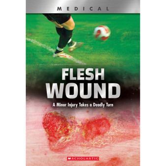 Flesh Wound: A Minor Injury Takes a Deadly Turn (XBooks) - ISBN 9780531132968
