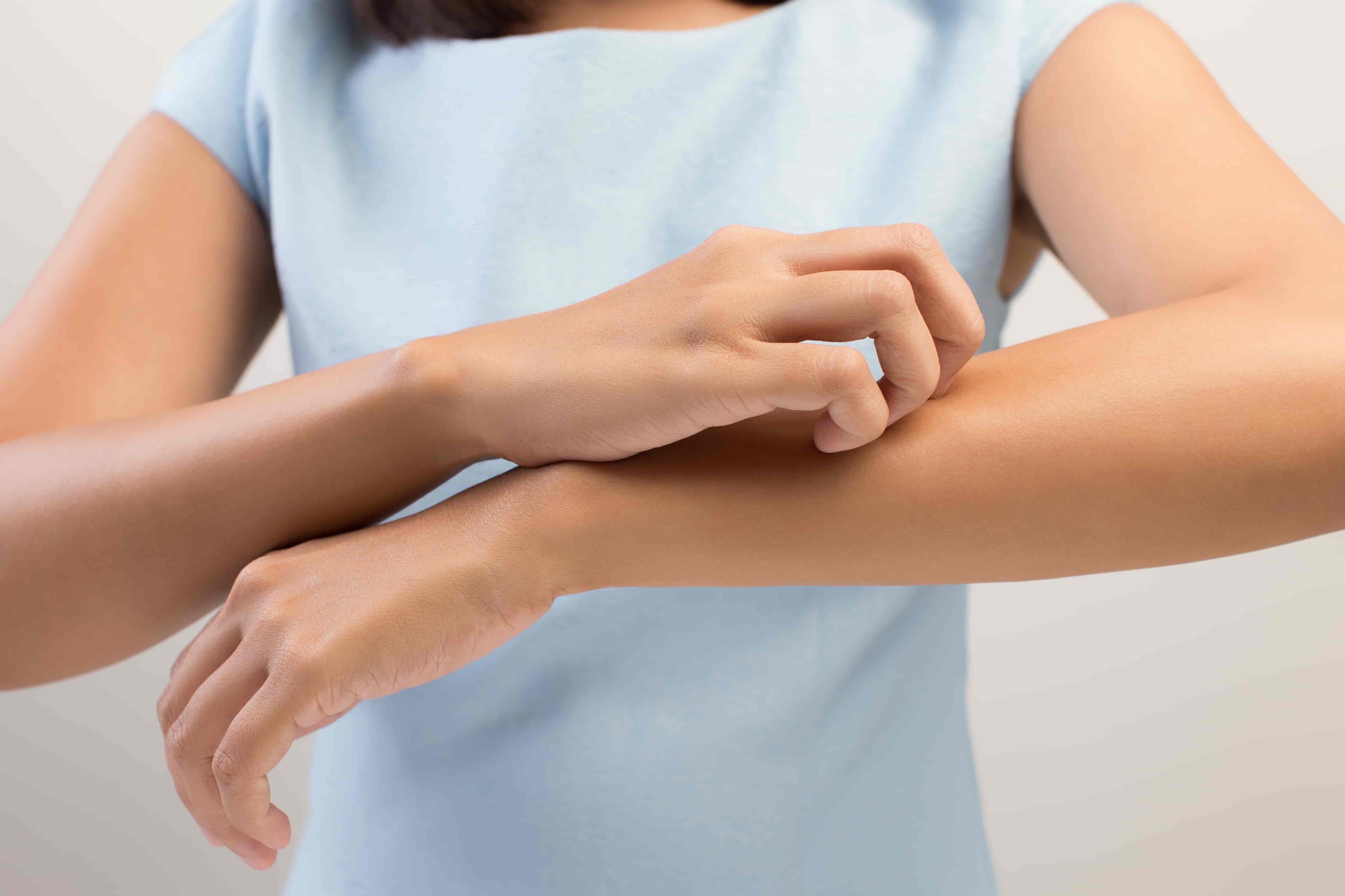 Frequent Eczema Breakouts? Learn How Infrared Therapy Can Help Frequent Eczema Breakouts? Learn How Infrared Therapy Can Help