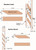 Surface Mount vs. Standard Jamb Line Drawing