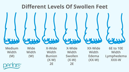 Pedors Shoes Swollen Feet Chart