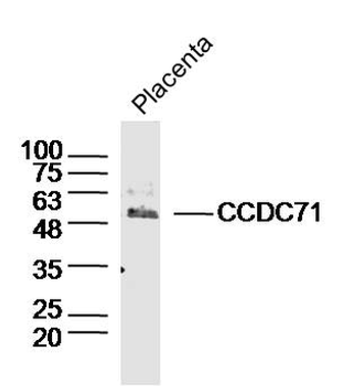 ***CCDC71 Polyclonal Antibody, 100 µL, Ship with an Ice Pack