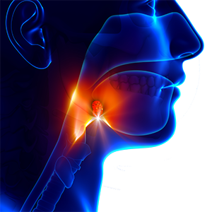 Learn about Throat Hit