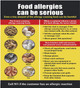 Food Allergies  (minium Rust Free, Commercial USE, 14.25X age