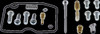Moose Carburetor Repair Kit 1003-1768 for 1993-1995 FOR KAWASAKI KLF 400 Bayou
