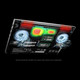 HP EliteBook 840 G11 Intel Core Ultra 5 135U Ordinateur portable 35,6 cm (14") Écran tactile WUXGA 16 Go DDR5-SDRAM 256 Go SSD Wi-Fi 6E (802.11ax) Windows 11 Pro AI PC Argent - A88ZPUC#ABA